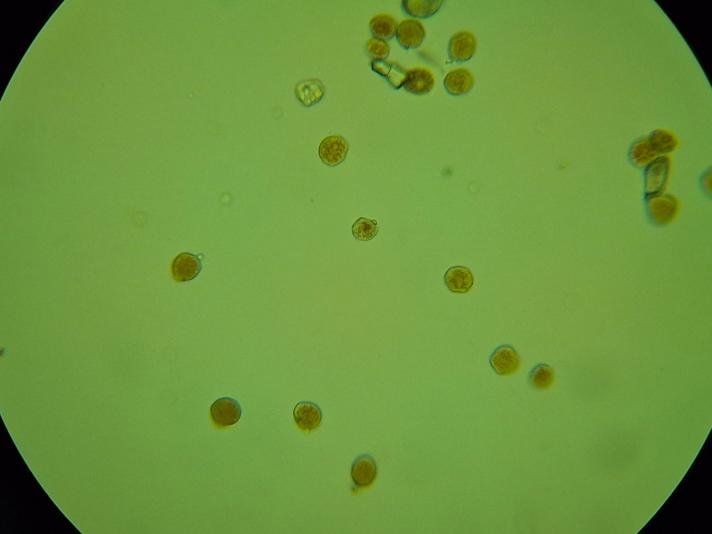 Puccinia obscura