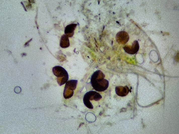 Microsphaera grossulariae