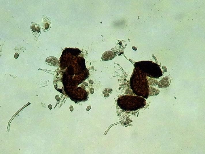 Microsphaera grossulariae