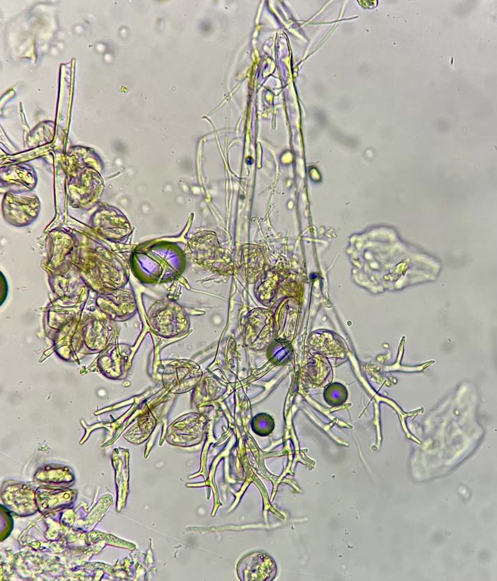 Peronospora viciae