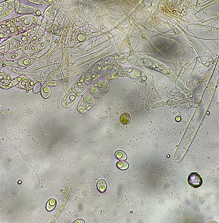 Octospora gyalectoides