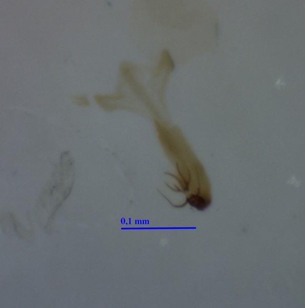 Edwardsiana plurispinosa (Edwardsiana plurispinosa)