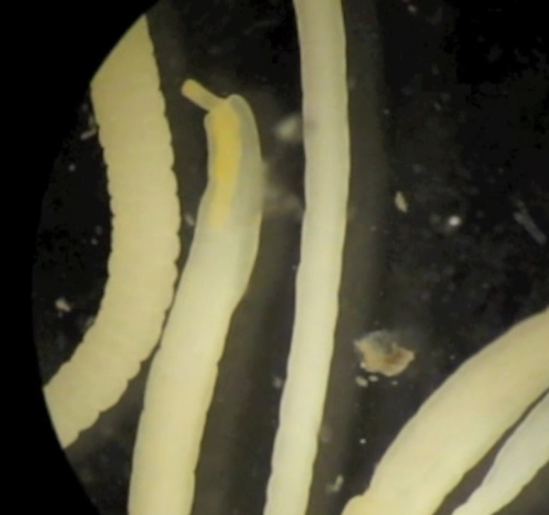 Echinorhynchus gadi (Echinorhynchus gadi)