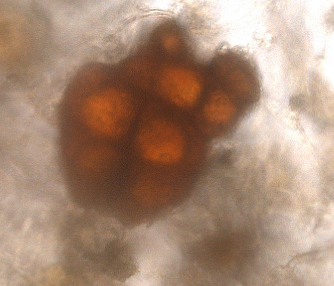 Rødknoldet Skævkapsel (Dicranella staphylina)