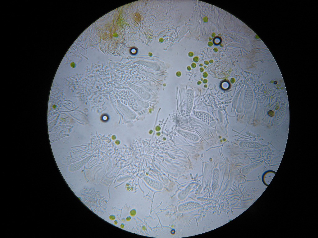 Mangesporet Kantskivelav (Lecanora sambuci)