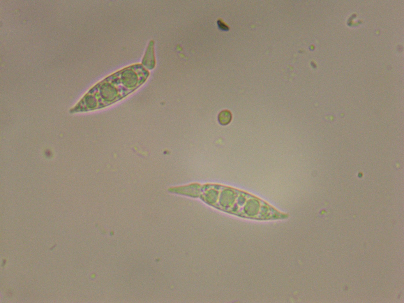 Anthostomella rubicola (Anthostomella rubicola)